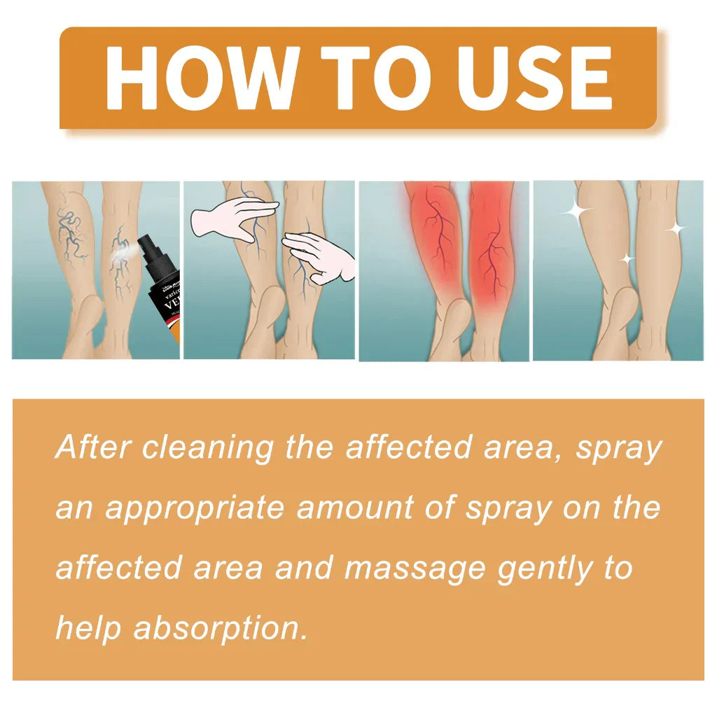 Turmeric Varicose Veins Relief Spray (BUY 1 GET 1 FREE)