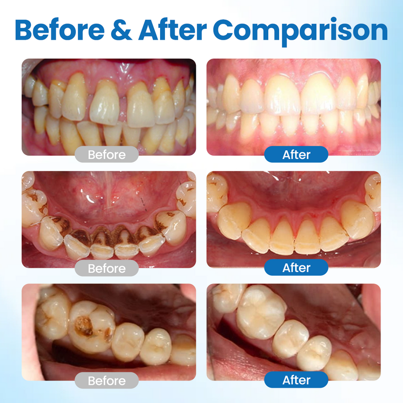 GermanyL™ NanoHAP Tooth Defense Serum (Buy 1 Get 1 Free)