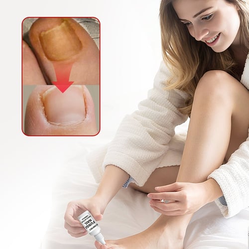 Toenail Fungus Treatment Extra Strength (BUY 1 GET 1 FREE)